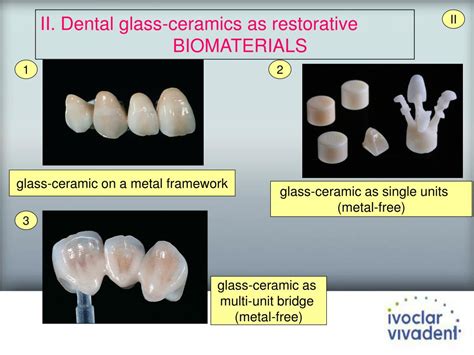 Vitrigifierat glas: En revolutionerande biomaterial för tandläkarsyfte och mer?